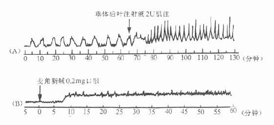 垂體后葉劑與麥角新堿對人子宮的作用
